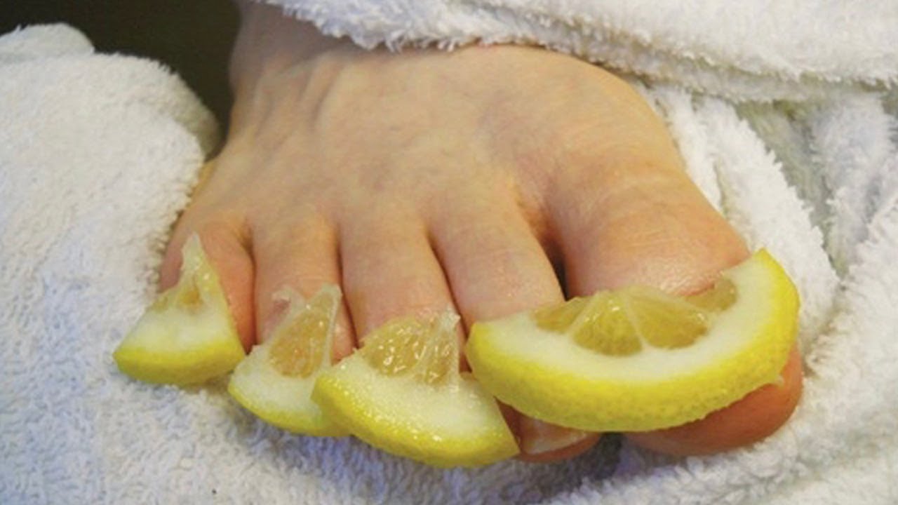 Народное средство при грибковой инфекции ногтей Народное средство при грибковой инфекции ногтей