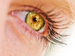 Блефаропластика, пластика век