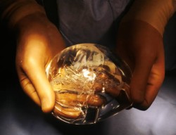 Достижения современной медицины в области пластической хирургии груди Достижения современной медицины в области пластической хирургии груди