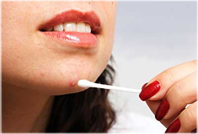 Фурункул причины и лечение Фурункул причины и лечение