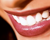 Красивая улыбка Красивая улыбка