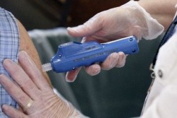 Местная анестезия безыгольным струйным способом