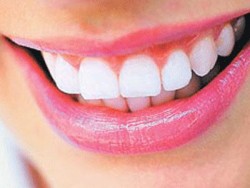 Реставрация зубов. Как можно отбелить зубы. Реставрация зубов. Как можно отбелить зубы.