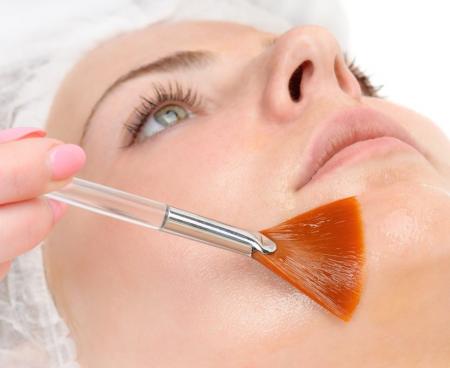  Поверхностный химический пилинг