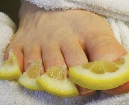 Народное средство при грибковой инфекции ногтей