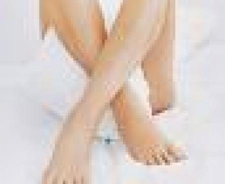 Лазерная эпиляция