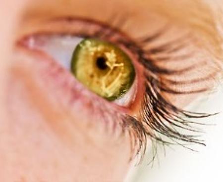 Блефаропластика, пластика век Блефаропластика, пластика век