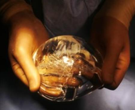 Достижения современной медицины в области пластической хирургии груди