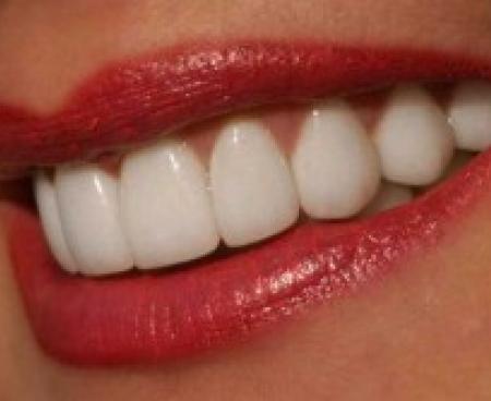 Синуслифтинг