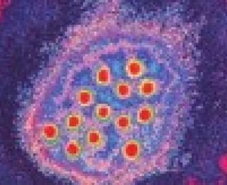 Вирус геппатита А