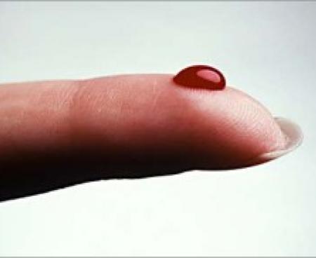 Анализ крови может определить раннюю стадию рака легких