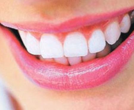 Реставрация зубов. Как можно отбелить зубы. Реставрация зубов. Как можно отбелить зубы.